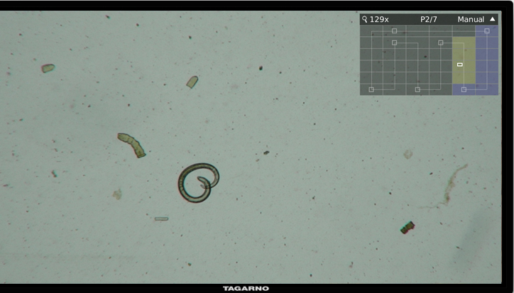Monitor with screenshot from TAGARNO's Trichinoscope app for digital microscopes