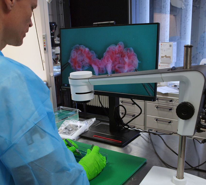 Over the shoulder shot of pathologist using digital microscope at pathology department to detect congenital malformations