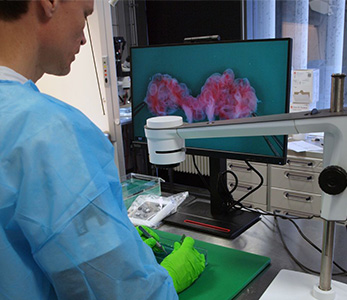 Over the shoulder shot of pathologist using digital microscope at pathology department to detect congenital malformations